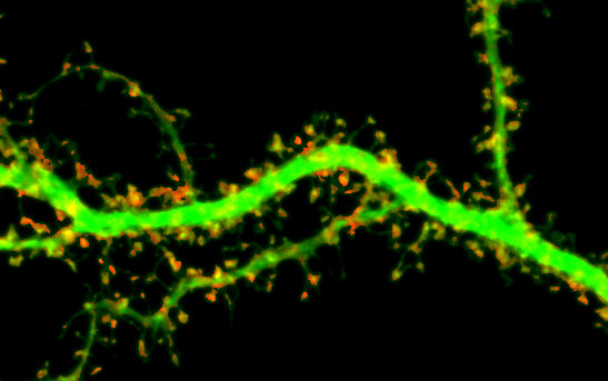 Microscopic image of a section of the dendritic arbor of a GFP-transfected rat hippocampal neuron stained for GFP (green) and phalloidin (red). Multiple dendritic spines (yellow overlay) form the postsynaptic site of connections from other neurons and are (reversibly) affected by isoflurane. (photo credit: Shelley Halpain, UC San Diego)